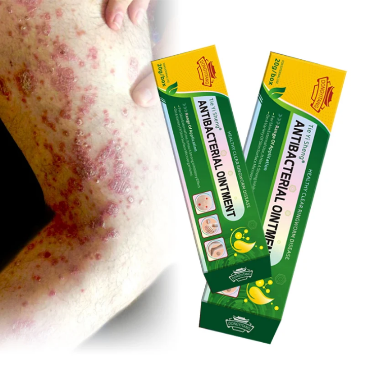 Découvrez Tie Yi Sheng® – Crème Antibactérienne Naturelle 🌿