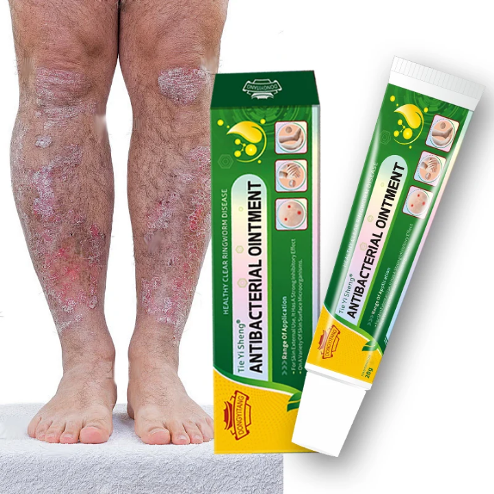 Découvrez Tie Yi Sheng® – Crème Antibactérienne Naturelle 🌿