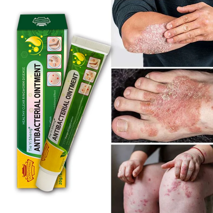 Découvrez Tie Yi Sheng® – Crème Antibactérienne Naturelle 🌿