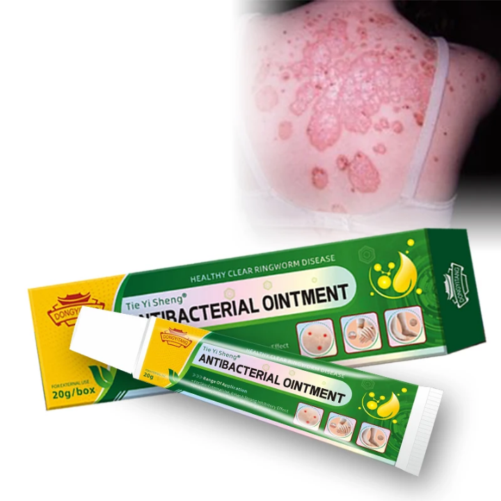 Découvrez Tie Yi Sheng® – Crème Antibactérienne Naturelle 🌿