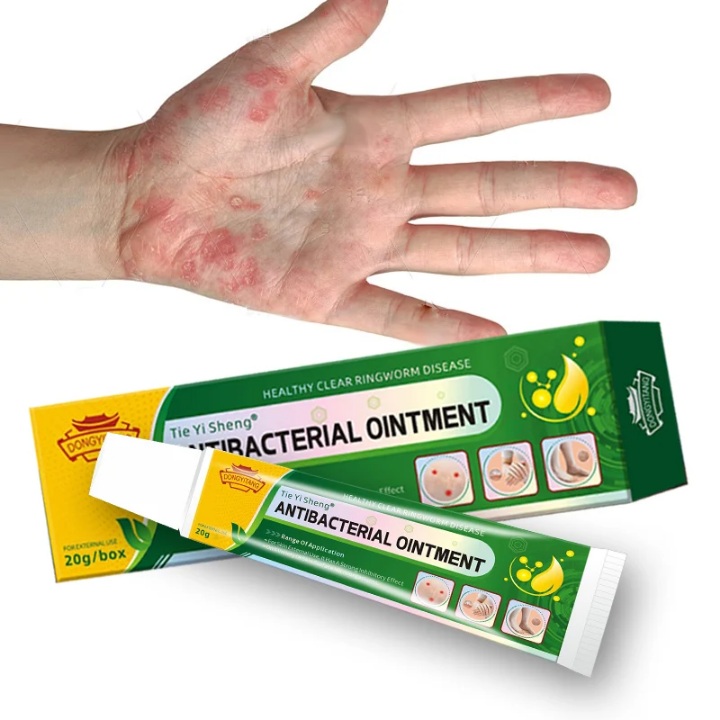 Découvrez Tie Yi Sheng® – Crème Antibactérienne Naturelle 🌿