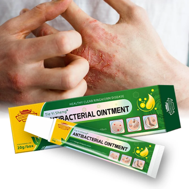 Découvrez Tie Yi Sheng® – Crème Antibactérienne Naturelle 🌿