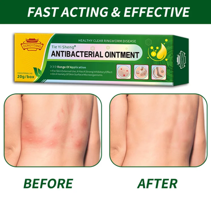 Découvrez Tie Yi Sheng® – Crème Antibactérienne Naturelle 🌿
